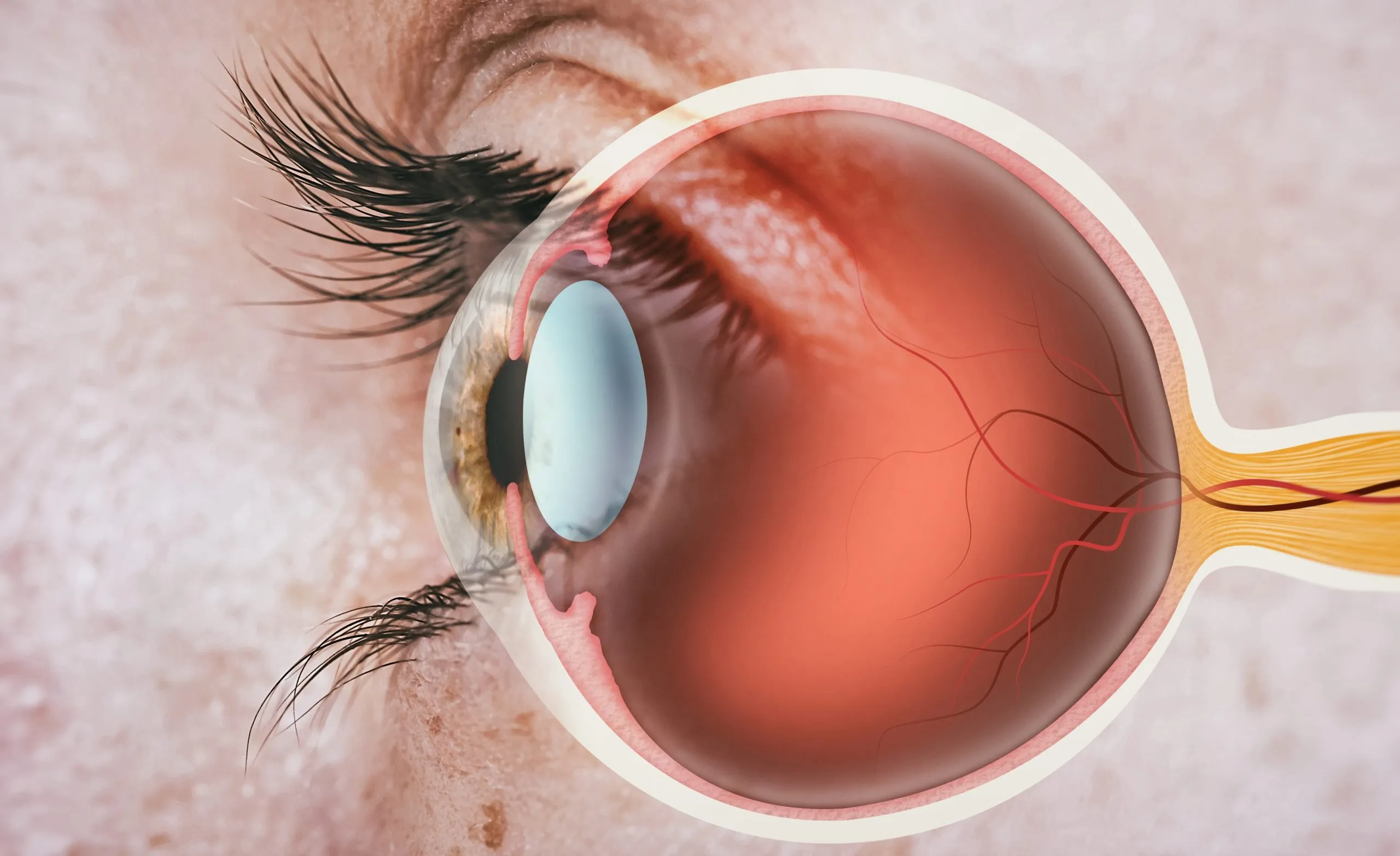 Retina Treatment
